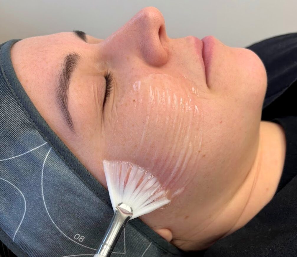 Advanced Chemical Peel Icon